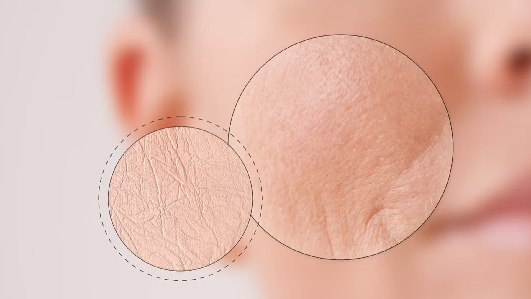 Dry vs. Dehydrated Skin: How to Tell the Difference and Treat Both This Fall